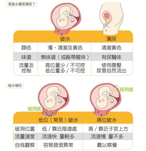 落紅|「3大產兆」破水．落紅．陣痛 ，代表即將臨盆？三分。